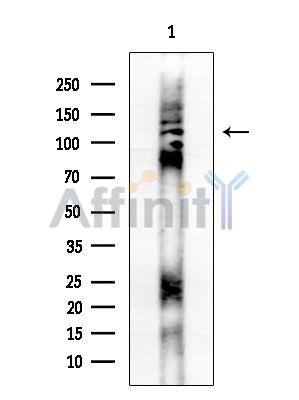 Phospho-Gli1 (Ser1071) Antibody - Western blot analysis of extracts from Mouse brain, using Phospho-Gli1 (Ser1071) Antibody at 1/1000 dilution.
