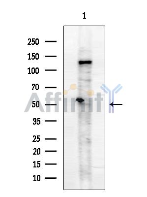 Phospho-SMYD2 (Ser283) Antibody - Western blot analysis of extracts from HUVEC cells, using Phospho-SMYD2 (Ser283) Antibody at 1/1000 dilution.