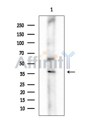 Phospho-CEBP Beta (Ser76) Antibody - Western blot analysis of extracts from Rat brain, using Phospho-CEBP Beta (Ser76) Antibody at 1/1000 dilution.