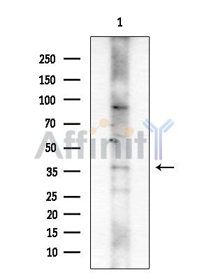 Phospho-CEBP Beta (Ser76) Antibody - Western blot analysis of extracts from COLO205 cells, using Phospho-CEBP Beta (Ser76) Antibody at 1/1000 dilution.