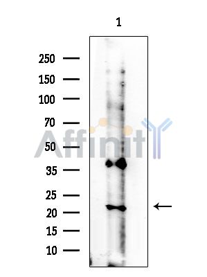 Phospho-TNNI3 (Ser23+Ser24) Antibody - Western blot analysis of extracts from COLO205 cells, using Phospho-TNNI3 (Ser23+Ser24) Antibody at 1/1000 dilution.
