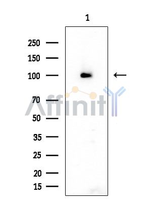 Phospho-DDR1 (Tyr520) Antibody - Western blot analysis of extracts from HUVEC cells, using Phospho-DDR1 (Tyr520) Antibody at 1/1000 dilution.
