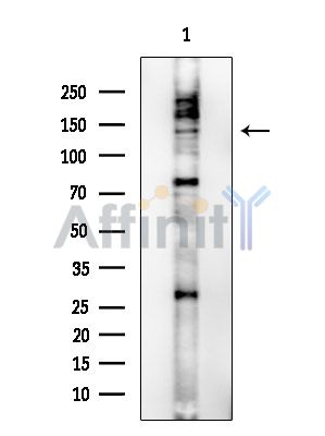 Phospho-ABL1/2 (Tyr70/Tyr116) Antibody - Western blot analysis of lysates from HUVEC cells, using Phospho-ABL1/2 (Tyr70/Tyr116) Antibody at 1/1000 dilution.