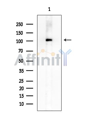 Phospho-EPHA8 (Tyr616) Antibody - Western blot analysis of extracts from Mouse brain, using Phospho-EPHA8 (Tyr616) Antibody at 1/1000 dilution.