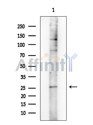 Phospho-LAB (Tyr136) Antibody - Western blot analysis of extracts from COLO205 cells, using Phospho-LAB (Tyr136) Antibody at 1/1000 dilution.