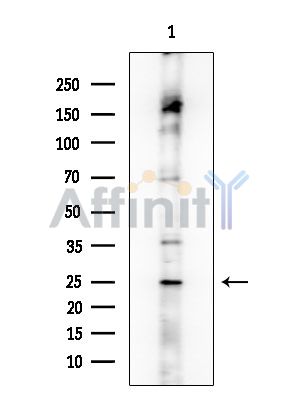 Phospho-LAB (Tyr136) Antibody - Western blot analysis of extracts from Rat brain, using Phospho-LAB (Tyr136) Antibody at 1/1000 dilution.