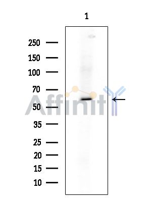 Phospho-Steroidogenic Factor 1 (Ser203) Antibody - Western blot analysis of extracts from Rat brain, using Phospho-Steroidogenic Factor 1 (Ser203) Antibody at 1/1000 dilution.