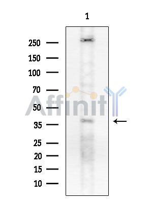 Phospho-AQP2 (Ser261) Antibody - Western blot analysis of lysates from HUVEC cells, using Phospho-AQP2 (Ser261) Antibody at 1/1000 dilution.