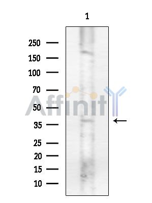 Phospho-AQP2 (Ser261) Antibody - Western blot analysis of lysates from Mouse brain, using Phospho-AQP2 (Ser261) Antibody at 1/1000 dilution.