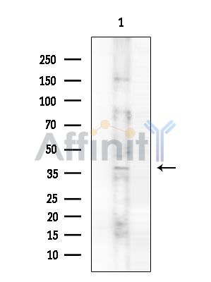 Phospho-AQP2 (Ser261) Antibody - Western blot analysis of lysates from Rat brain, using Phospho-AQP2 (Ser261) Antibody at 1/1000 dilution.