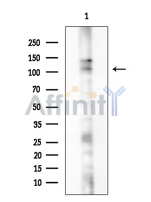Phospho-DDR1 (Tyr796) Antibody - Western blot analysis of extracts from COLO205 cells, using Phospho-DDR1 (Tyr796) Antibody at 1/1000 dilution.