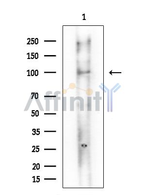 Phospho-ROR2 (Ser449) Antibody - Western blot analysis of extracts from Mouse brain, using Phospho-ROR2 (Ser449) Antibody at 1/1000 dilution.