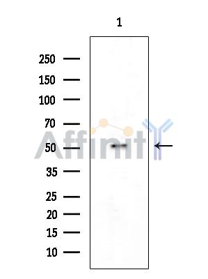 Phospho-STYK1/NOK (Tyr327) Antibody - Western blot analysis of extracts from COLO205 cells, using Phospho-STYK1/NOK (Tyr327) Antibody at 1/1000 dilution.