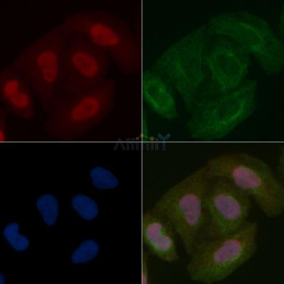 SSH3 Mouse Monoclonal Antibody - BF8560 staining Hela cells by IF/ICC.