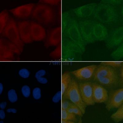 Mitofusin 2 Mouse Monoclonal Antibody - BF8563 staining Hela cells by IF/ICC.