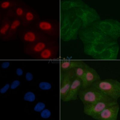 SAP62 Mouse Monoclonal Antibody - BF8592 staining Hela cells by IF/ICC.