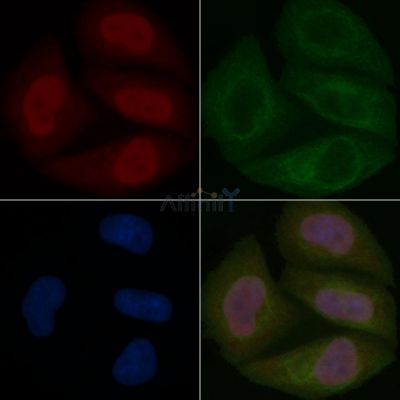 N myc interactor Mouse Monoclonal Antibody - BF8595 staining Hela cells by IF/ICC.
