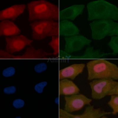 PAX3 Mouse Monoclonal Antibody - BF8598 staining Hela cells by IF/ICC.