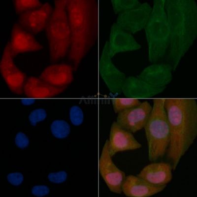 p53 Mouse Monoclonal Antibody - BF8609 staining Hela cells by IF/ICC.