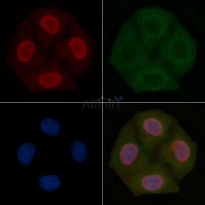 PPP1CA Mouse Monoclonal Antibody - BF8613 staining Hela cells by IF/ICC.