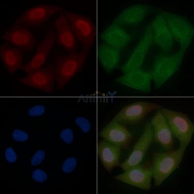Phospho-FOXO1A (Ser329) Mouse Monoclonal Antibody - BF8616 staining Hela cells by IF/ICC.