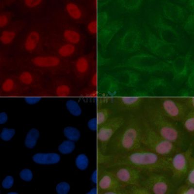 Apc11 Mouse Monoclonal Antibody - BF8619 staining Hela cells by IF/ICC.
