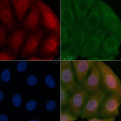 ALS2CR2 Mouse Monoclonal Antibody - BF8626 staining Hela cells by IF/ICC.
