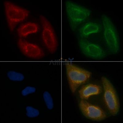 AWAT2 Mouse Monoclonal Antibody - BF8639 staining Hela cells by IF/ICC.