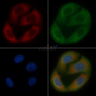 ALDH3B2 Mouse Monoclonal Antibody - BF8640 staining Hela cells by IF/ICC.