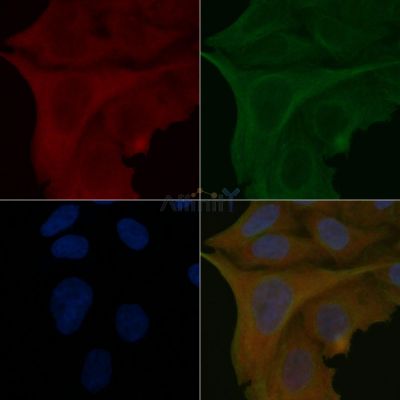CEP27 Mouse Monoclonal Antibody - BF8644 staining Hela cells by IF/ICC.