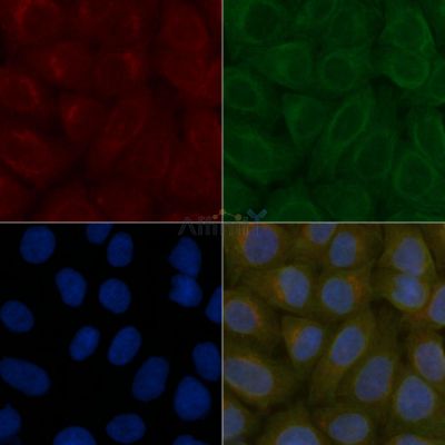 COPG Mouse Monoclonal Antibody - BF8646 staining Hela cells by IF/ICC.