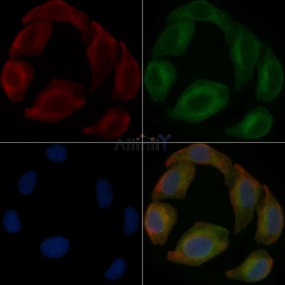 TBC1D21 Mouse Monoclonal Antibody - BF8680 staining Hela cells by IF/ICC.