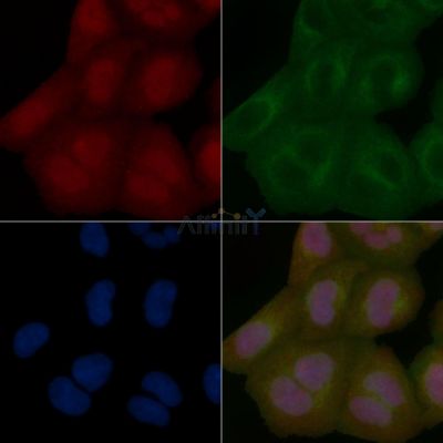 USP21 Mouse Monoclonal Antibody - BF8692 staining Hela cells by IF/ICC.