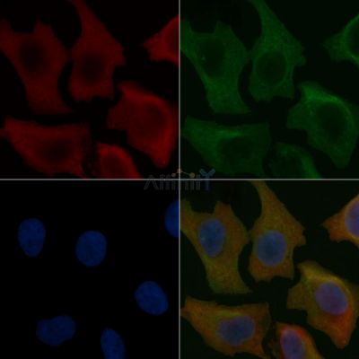 GUCA1A Mouse Monoclonal Antibody - BF8693 staining Hela cells by IF/ICC.