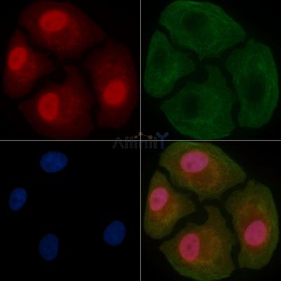 GATAD2A Mouse Monoclonal Antibody - BF8703 staining Hela cells by IF/ICC.
