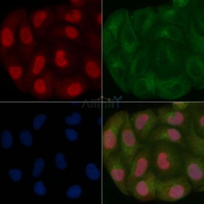 PCGF1 Mouse Monoclonal Antibody - BF8704 staining Hela cells by IF/ICC.