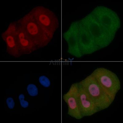 ZFX Mouse Monoclonal Antibody - BF8722 staining Hela cells by IF/ICC.