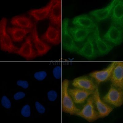 PMPCA Mouse Monoclonal Antibody - BF8725 staining Hela cells by IF/ICC.