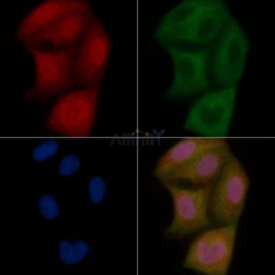 MBNL2 Mouse Monoclonal Antibody - BF8749 staining Hela cells by IF/ICC.