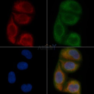 ALG6 Mouse Monoclonal Antibody - BF8754 staining Hela cells by IF/ICC.