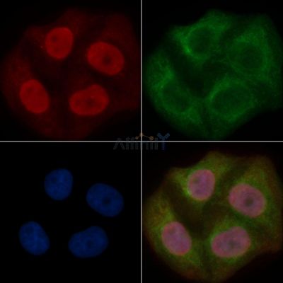 WDR70 Mouse Monoclonal Antibody - BF8763 staining Hela cells by IF/ICC.