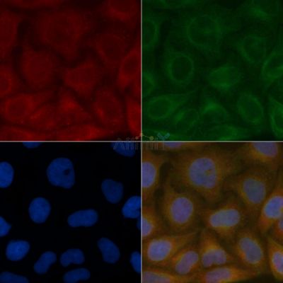RFT1 Mouse Monoclonal Antibody - BF8768 staining Hela cells by IF/ICC.