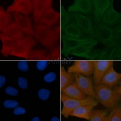 TST Mouse Monoclonal Antibody - BF8777 staining Hela cells by IF/ICC.