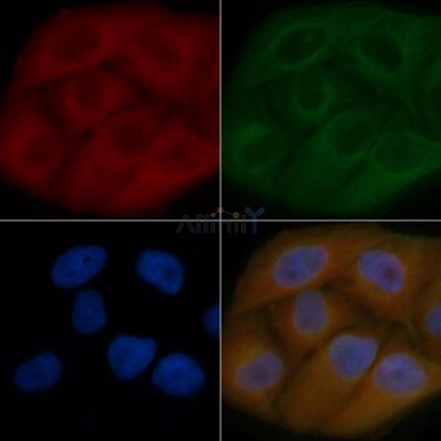 POMK Mouse Monoclonal Antibody - BF8781 staining Hela cells by IF/ICC.