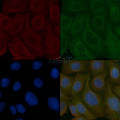 FAF2 Mouse Monoclonal Antibody - BF8789 staining Hela cells by IF/ICC.