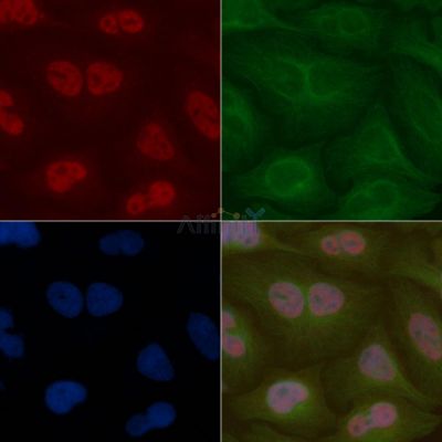 PRCC Mouse Monoclonal Antibody - BF8797 staining Hela cells by IF/ICC.