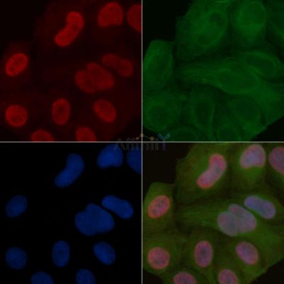 TDRD3 Mouse Monoclonal Antibody - BF8817 staining Hela cells by IF/ICC.