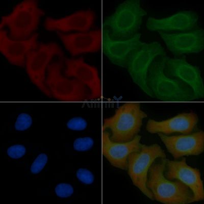 ZER1 Mouse Monoclonal Antibody - BF8820 staining Hela cells by IF/ICC.
