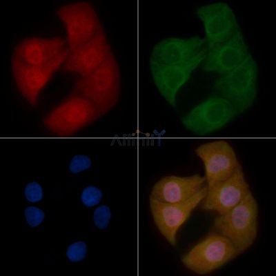 MeCP2 Mouse Monoclonal Antibody - BF8831 staining Hela cells by IF/ICC.