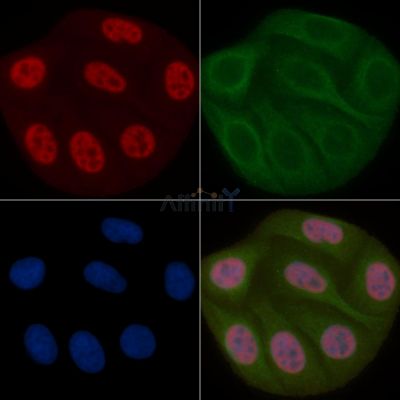 NUFIP1 Mouse Monoclonal Antibody - BF8832 staining Hela cells by IF/ICC.